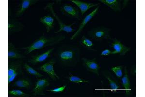 Immunofluorescence of purified MaxPab antibody to CETN3 on HeLa cell.