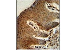 PTMS Antibody (C-term) (ABIN653227 and ABIN2842761) IHC analysis in formalin fixed and paraffin embedded human skin followed by peroxidase conjugation of the secondary antibody and DAB staining. (Parathymosin antibody  (C-Term))