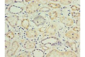 Immunohistochemistry of paraffin-embedded human kidney tissue using ABIN7157726 at dilution of 1:100 (KLF3 antibody  (AA 1-240))