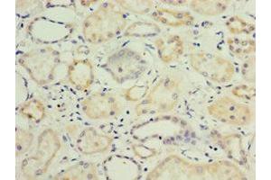 Immunohistochemistry of paraffin-embedded human kidney tissue using ABIN7157726 at dilution of 1:100 (KLF3 antibody  (AA 1-240))