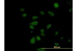 Image no. 4 for anti-CDK5 Regulatory Subunit Associated Protein 3 (CDK5RAP3) (AA 1-507) antibody (ABIN599311) (CDK5RAP3 antibody  (AA 1-507))
