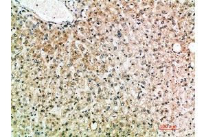 Immunohistochemical analysis of paraffin-embedded human-liver, antibody was diluted at 1:200 (IL-19 antibody  (AA 51-100))