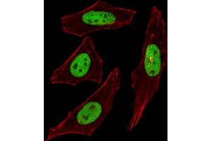 Fluorescent image of Hela cells stained with SUMO2/3 Antibody (C-term) (ABIN388034 and ABIN2845512). (SUMO2/3 antibody  (C-Term))