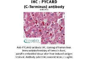 Image no. 1 for anti-PYD and CARD Domain Containing (PYCARD) (C-Term) antibody (ABIN1738638) (PYCARD antibody  (C-Term))