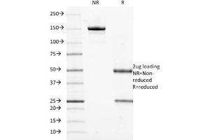 SDS-PAGE Analysis of Purified, BSA-Free Cytokeratin 18 Antibody (clone DE-K18). (Cytokeratin 18 antibody)