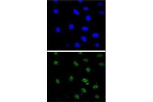 Confocal immunofluorescent analysis of PTEN antibody with 293 cells followed by Alexa Fluor 488-conjugated goat anti-rabbit lgG (green). (PTEN antibody  (AA 306-335))