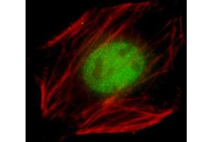 Immunofluorescent analysis of 4 % paraformaldehyde-fixed, 0. (NK2 Homeobox 5 antibody  (AA 98-133))