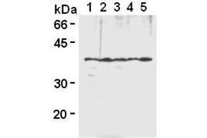 Western Blotting (WB) image for anti-Heterogeneous Nuclear Ribonucleoprotein A2/B1 (HNRNPA2B1) antibody (ABIN1449240) (HNRNPA2B1 antibody)