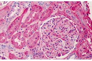 Human Kidney: Formalin-Fixed, Paraffin-Embedded (FFPE) (APOA1 antibody)