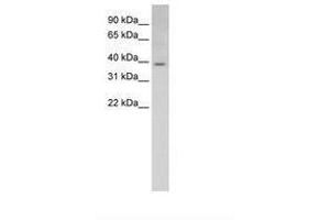 Image no. 1 for anti-E74-Like Factor 3 (Ets Domain Transcription Factor, Epithelial-Specific) (ELF3) (AA 201-250) antibody (ABIN6736609) (ELF3 antibody  (AA 201-250))