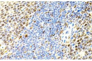 Immunohistochemistry of paraffin-embedded Mouse spleen using EIF4G2 Polyclonal Antibody (EIF4G2 antibody)