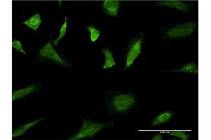 Immunofluorescence of monoclonal antibody to MAPK3 on HeLa cell. (ERK1 antibody  (AA 279-379))
