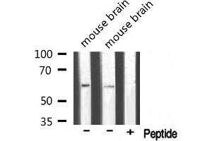 Western blot analysis of extracts of various samples,using T3JAM Antibody. (TRAF3IP3 antibody  (Internal Region))