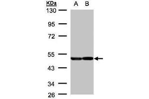 WB Image Sample(30 μg of whole cell lysate) A:A431, B:H1299 10% SDS PAGE antibody diluted at 1:2000 (ENO2/NSE antibody)