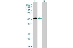 Western Blot analysis of F9 expression in transfected 293T cell line by F9 monoclonal antibody (M01), clone 2C9. (Coagulation Factor IX antibody  (AA 96-190))