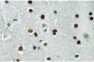 Immunohistochemistry (IHC) analyzes of ASCL1 antibody in paraffin-embedded human brain tissue. (ASCL1 antibody)