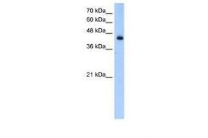 Image no. 1 for anti-Acyl-CoA Dehydrogenase, Long Chain (ACADL) (N-Term) antibody (ABIN6737736) (ACADL antibody  (N-Term))