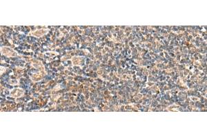 Immunohistochemistry of paraffin-embedded Human tonsil tissue using SEC22B Polyclonal Antibody at dilution of 1:60(x200) (SEC22B antibody)