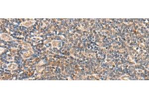 Immunohistochemistry of paraffin-embedded Human tonsil tissue using SEC22B Polyclonal Antibody at dilution of 1:60(x200)