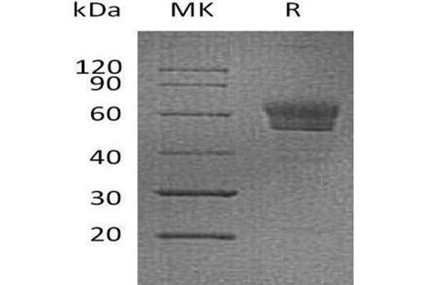 Podoplanin Protein (PDPN) (Fc Tag)