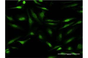 Immunofluorescence of monoclonal antibody to CALCOCO2 on HeLa cell. (CALCOCO2 antibody  (AA 347-446))