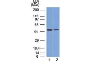Western blot testing of human 1) MCF7 (breast) and 2) PC3 (prostate) cell lysate with FOXA1 antibody (clone FOXA1/1512). (FOXA1 antibody  (AA 372-472))