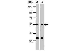 WB Image Sample(30 μg of whole cell lysate) A:HeLa S3 , B:MOLT4 , 15% SDS PAGE antibody diluted at 1:1000 (GPS1 antibody  (C-Term))