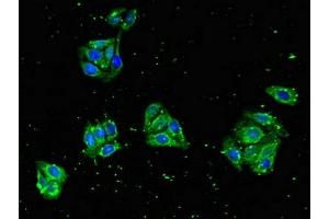 Immunofluorescent analysis of HepG2 cells using ABIN7151001 at dilution of 1:100 and Alexa Fluor 488-congugated AffiniPure Goat Anti-Rabbit IgG(H+L) (ZNF645 antibody  (AA 200-413))