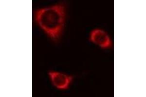 ABIN6277699 staining A549 cells by IF/ICC. (CSTA antibody  (C-Term))