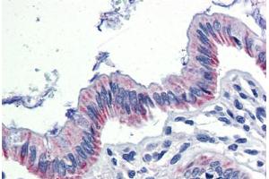 Human Colon (formalin-fixed, paraffin-embedded) stained with EGR2 antibody ABIN462263 followed by biotinylated goat anti-rabbit IgG secondary antibody ABIN481713, alkaline phosphatase-streptavidin and chromogen. (EGR2 antibody  (AA 397-446))