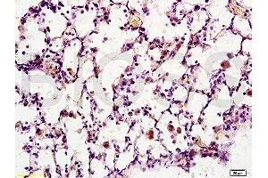 Formalin-fixed and paraffin embedded rat brain tissue labeled with Anti-Synaptotagmin 1/SYT1 Polyclonal Antibody, Unconjugated (ABIN754888) at 1:200 followed by conjugation to the secondary antibody, (SP-0023), and DAB staining (Synaptotagmin antibody  (AA 165-260))