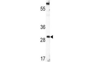 Western blot analysis of BDNF antibody and CEM lysate. (BDNF antibody  (AA 206-236))