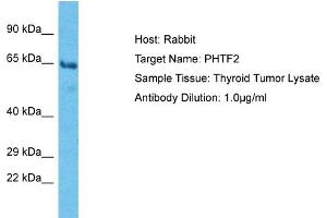 Host: Rabbit Target Name: PHTF2 Sample Type: Thyroid tumor lysates Antibody Dilution: 1. (PHTF2 antibody  (C-Term))