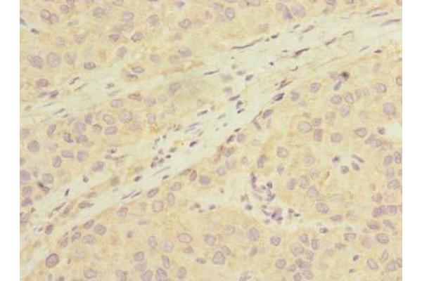 LHPP antibody  (AA 1-270)