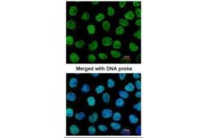 ICC/IF Image Immunofluorescence analysis of paraformaldehyde-fixed A431, using APE1, antibody at 1:200 dilution. (APEX1 antibody  (N-Term))