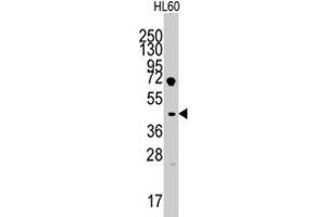 LEFTY1 Antikörper  (AA 291-320)
