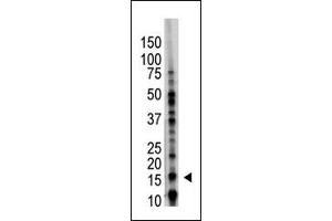 Image no. 1 for anti-Ubiquitin-Conjugating Enzyme E2B (UBE2B) (C-Term) antibody (ABIN357490) (UBE2B antibody  (C-Term))