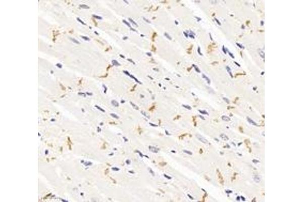 Desmoplakin antibody