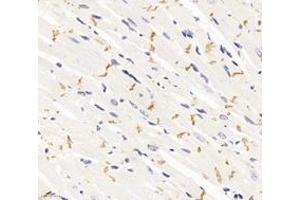 Immunohistochemistry analysis of paraffin-embedded rat heart using,DSP (ABIN7073719) at dilution of 1: 1000 (Desmoplakin antibody)