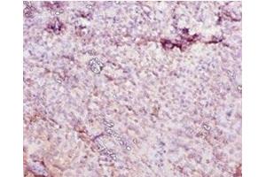 Immunohistochemistry of paraffin-embedded human tonsil tissue using ABIN7177073 at dilution of 1:10