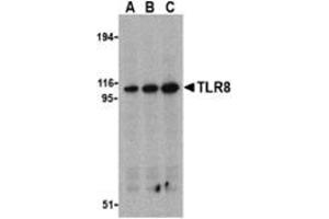 Western blot analysis of TLR8 in Daudi cell lysates with this product at (A) 0. (TLR8 antibody  (Middle Region))