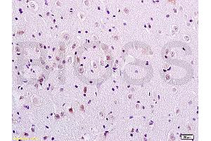 Formalin-fixed and paraffin embedded rat brain tissue labeled with Anti-FOXC1/FREAC3 Polyclonal Antibody, Unconjugated (ABIN719291) at 1:200 followed by conjugation to the secondary antibody and DAB staining (FOXC1 antibody  (AA 101-200))