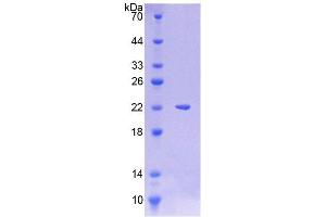 SDS-PAGE (SDS) image for Lysosomal-Associated Membrane Protein 3 (LAMP3) (AA 222-381) protein (His tag) (ABIN4988771)