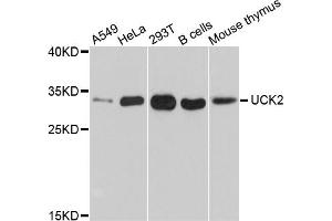 Western blot analysis of extracts of various cell lines, using UCK2 antibody (ABIN5999140) at 1/1000 dilution.