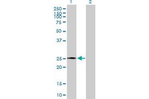 Western Blot analysis of AMELX expression in transfected 293T cell line by AMELX MaxPab polyclonal antibody. (AMELX antibody  (AA 1-191))