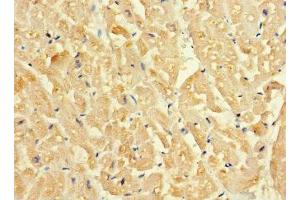 Immunohistochemistry of paraffin-embedded human heart tissue using ABIN7160153 at dilution of 1:100 (SLC16A1 antibody  (AA 159-201))