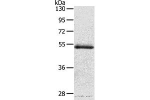 Western blot analysis of Human normal colon sigmoideum tissue, using OLFM4 Polyclonal Antibody at dilution of 1:200 (Olfactomedin 4 antibody)