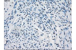 Immunohistochemical staining of paraffin-embedded endometrium tissue using anti-FHmouse monoclonal antibody. (FH antibody)