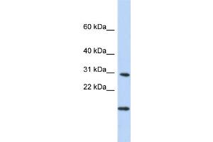 WB Suggested Anti-POLR2K Antibody Titration:  0. (POLR2K antibody  (Middle Region))