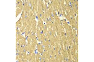 Immunohistochemistry of paraffin-embedded mouse heart using TPM3 antibody (ABIN6291029) at dilution of 1:100 (40x lens). (TPM3 antibody)